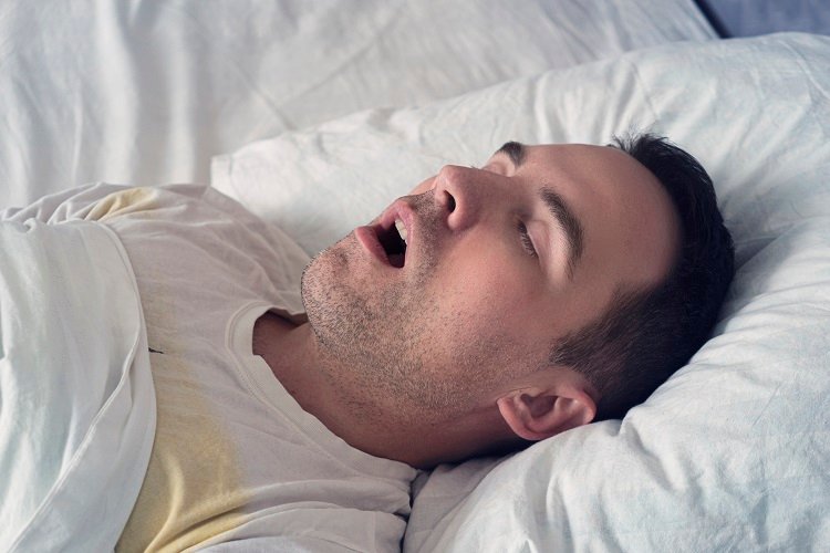 Sleep Apnoea and Snoring: Effective Strategies for Managing Symptoms